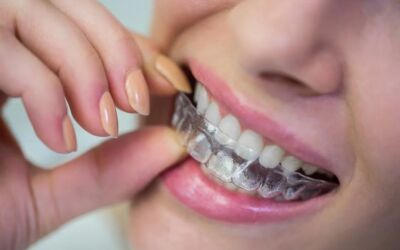 The Benefits of Invisalign: Achieve a Straighter Smile with Chatham Family Dental