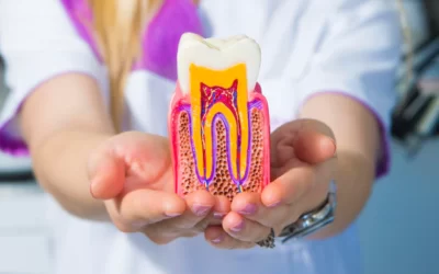 What to Do When a Tooth Filling Falls Out?