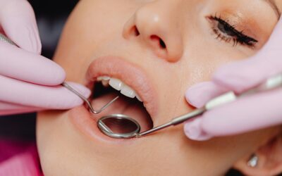 How Often Should You Visit the Dentist for Check-ups?