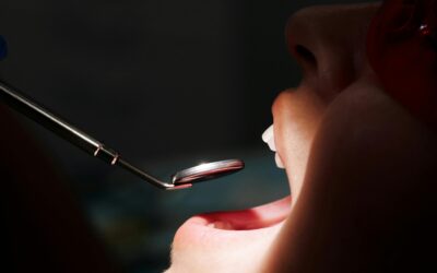 A Guide to Maintaining White Teeth