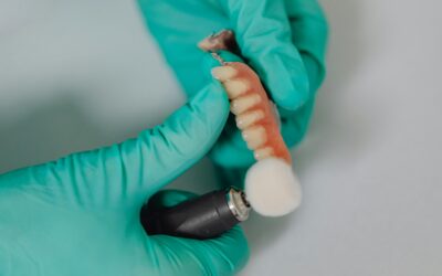 Benefits of Dental Implants Over Dentures