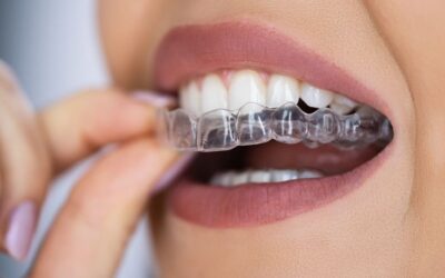 Invisalign vs. Metal Braces: A Chatham Patient’s Guide to Straight Teeth