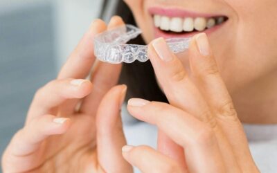How Long Does Invisalign Take? A Timeline from Your Chatham Dental Team